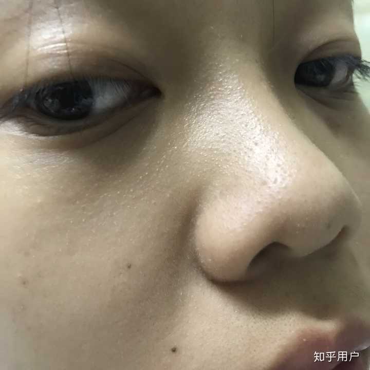 但是我周边的女孩子,个个皮肤都很好啊,很年轻很嫩的皮肤状态