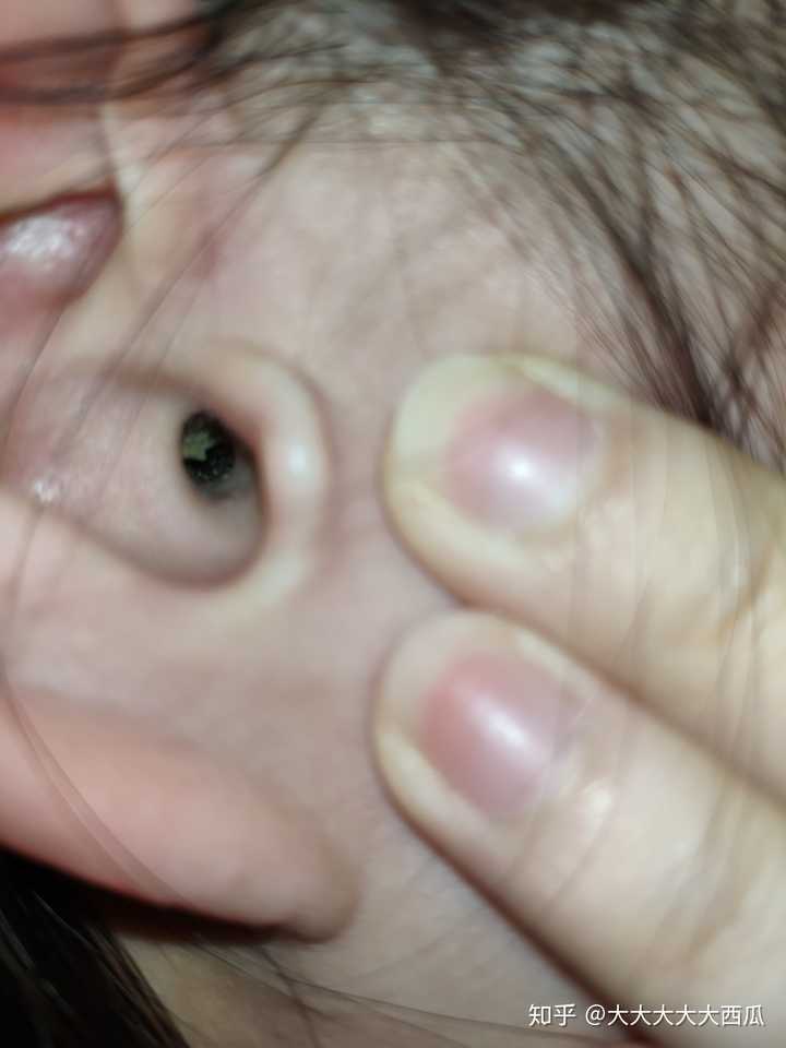 需要放大看  那一面黑色的墙就是耳屎 两只耳朵都是的_§:з)))」∠