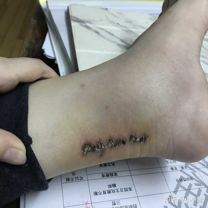 希望明天能消下去点,唉 大家洗纹身得话还是好好注意,千万别感染 一