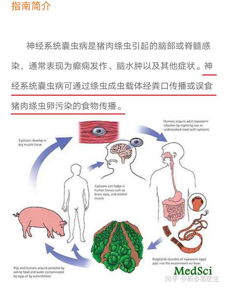 脑囊虫病的传播途径