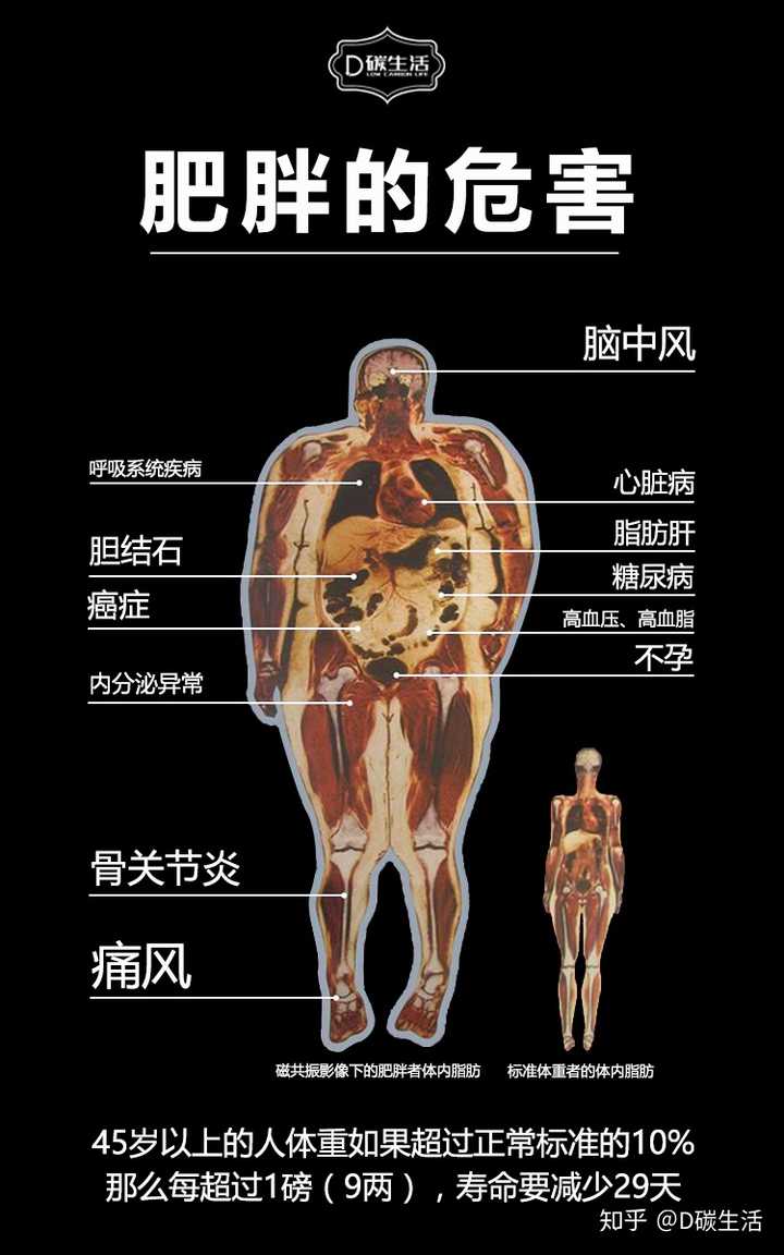 你超重/肥胖了吗?