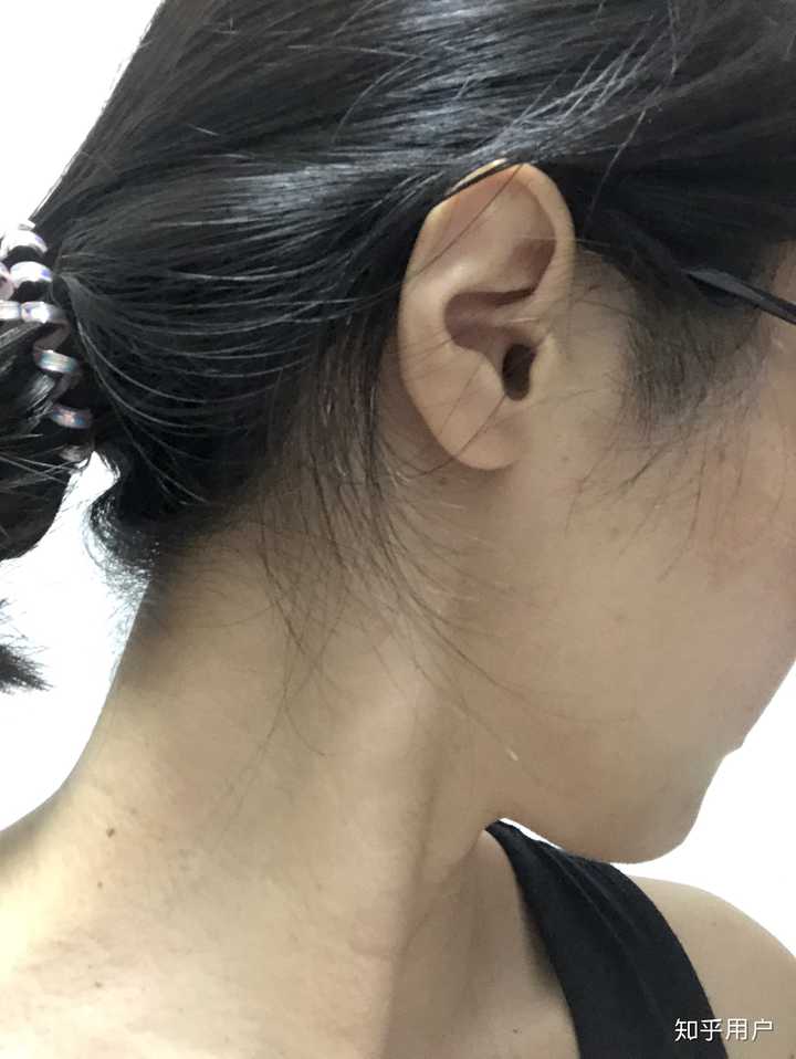 女生鬓角头发多且浓厚是一种怎么样的体验?