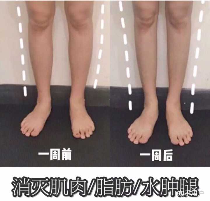 怎么快速瘦腿?