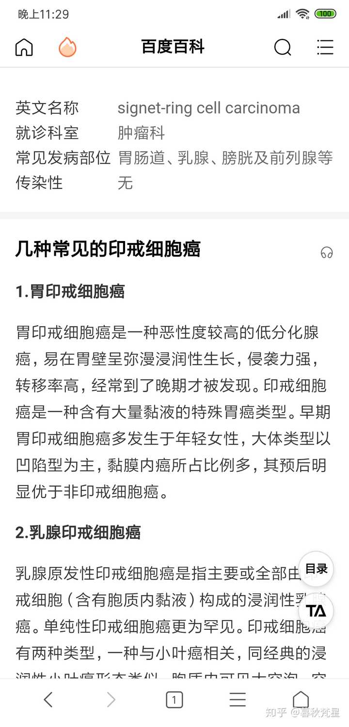 如何看待歌手吾恩患「皮革胃,确诊胃印戒细胞癌?