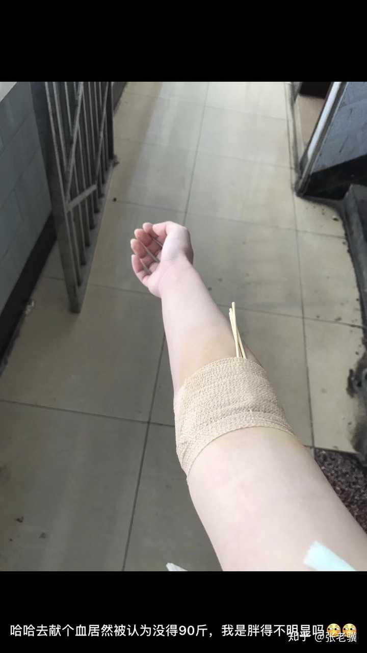 然后是去献血的时候拍了手臂的照片,图片中可以看出我是粉调偏白一点