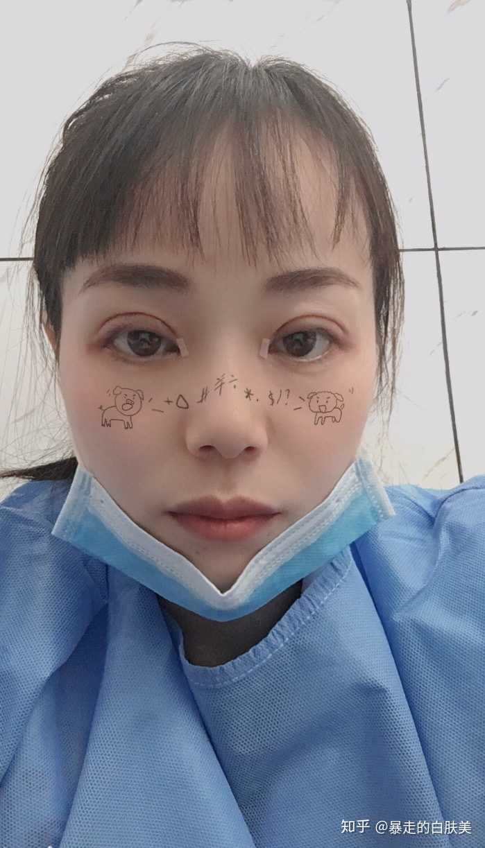 割双眼皮后用的冰袋不会有细菌感染伤口吗,从哪买比较