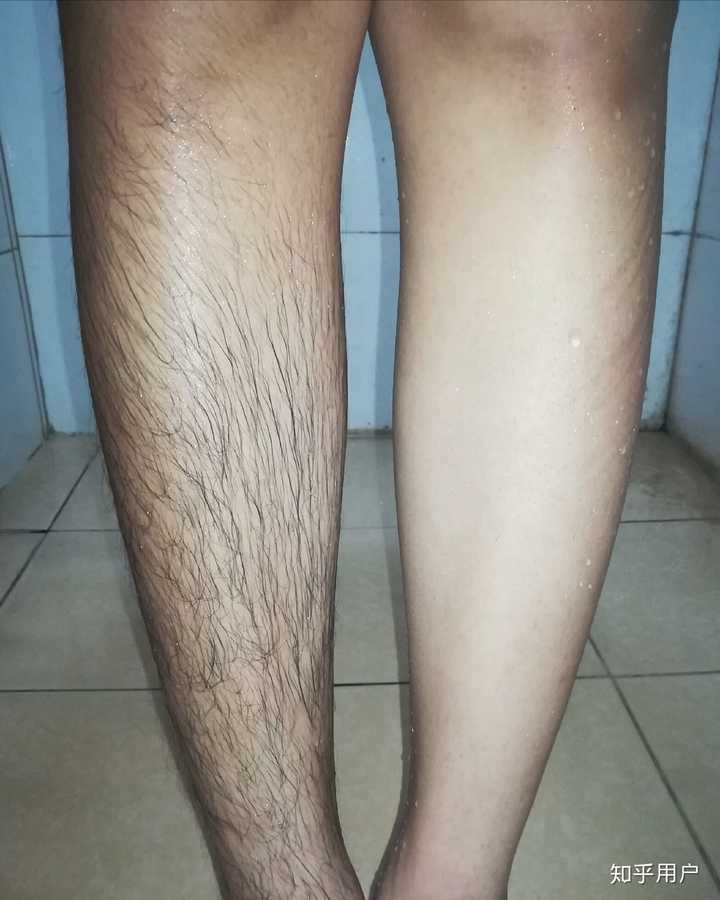 男生穿短裤要不要刮腿毛(腿毛重)?
