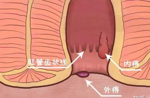 梳状线又称"齿状线"