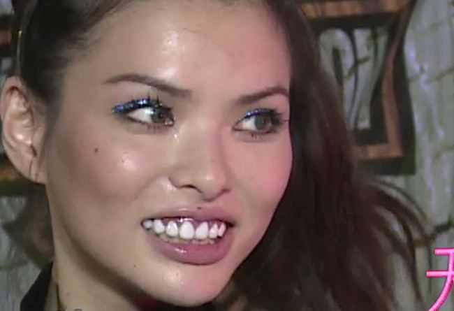 说说龅牙却长得还不错的女明星