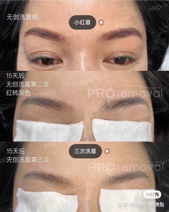 纹眉失败洗眉一种怎样的体验?