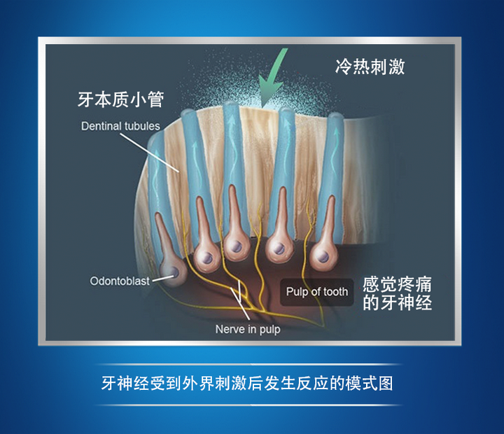 磨损,楔状缺损和牙龈萎缩等,会导致牙本质小管暴露,在受到冷,热等外界