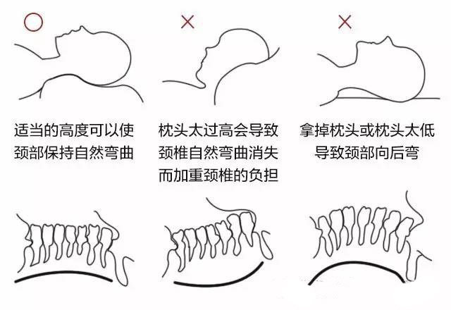 有哪些对颈椎有好处的生活习惯或实用品?