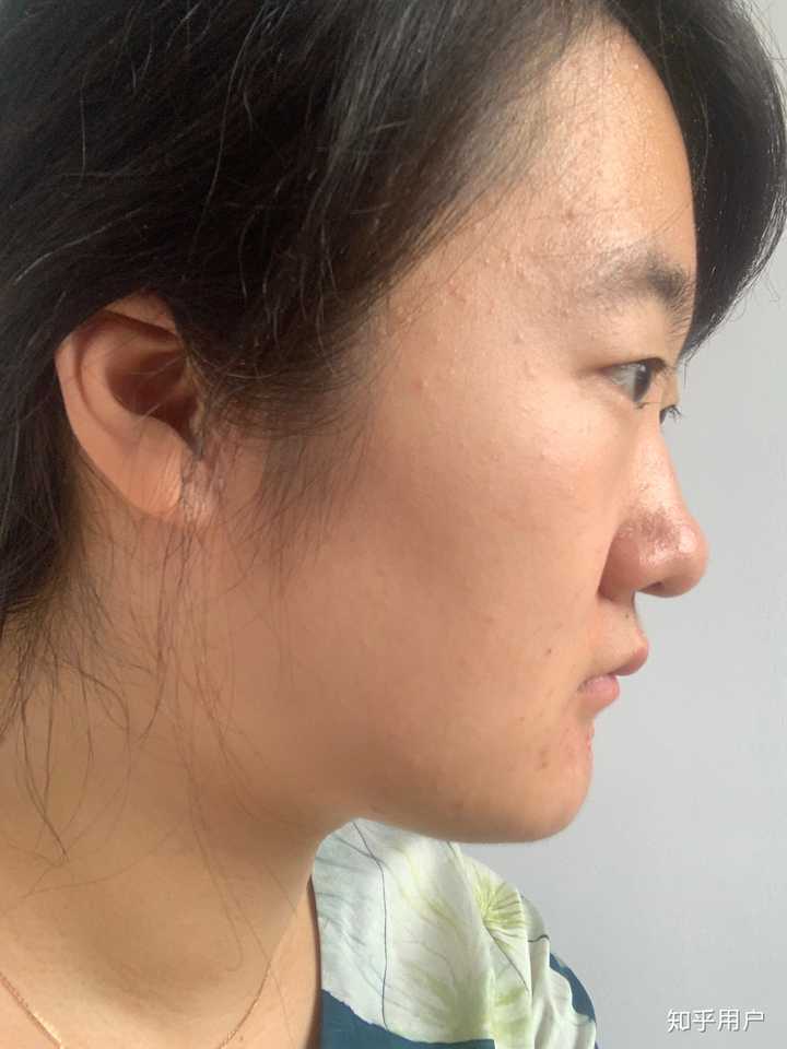 正脸好看但侧脸丑到爆是种怎样的体验?