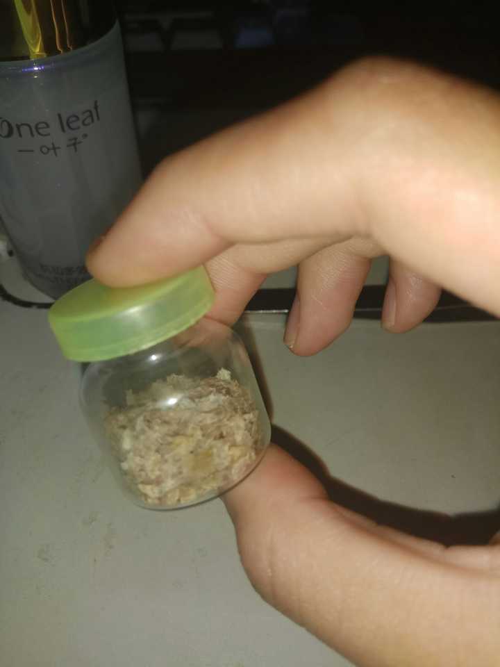 为什么抠下来大块的头皮屑会有瞬间的快感?