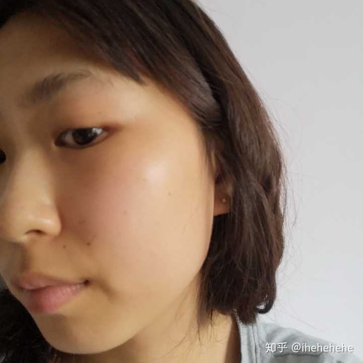 左右脸不对称是一种什么感觉?