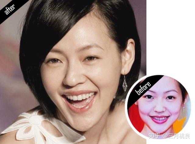 不得不说一口小白牙齿很美,牙齿真的对颜值的影响是致命的呀!