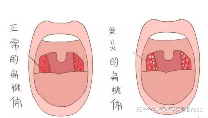 有两个拱形组织组成; 一个腭舌弓和一个叫腭咽弓,分别跨在两侧,形成两