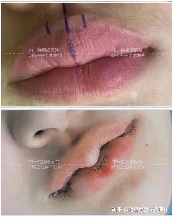 桃心唇#