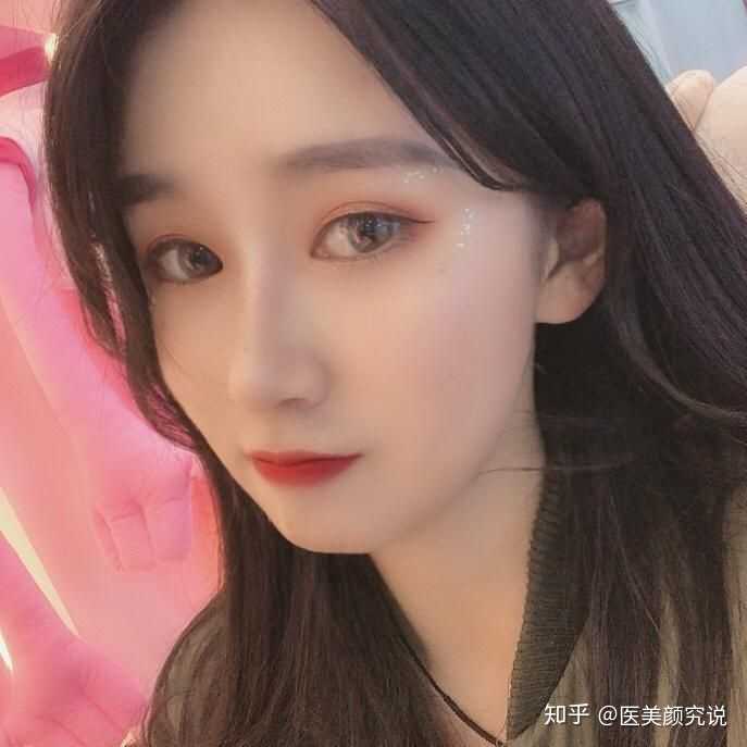 从照片上看题主的颜值基础挺好的,只是鼻梁不够挺,面部有些婴儿肥
