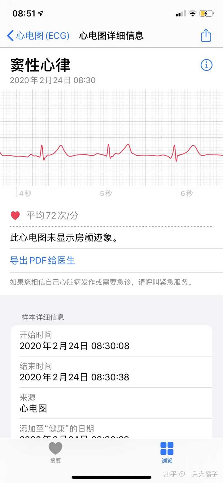 国行苹果手表apple watch如何开通ecg功能?