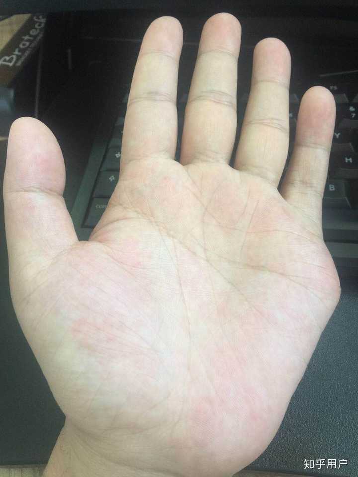 六指人的生活是怎样的?