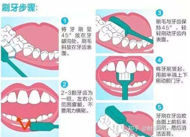 坚持每天早晚刷牙,牙上的黑点会去掉吗?