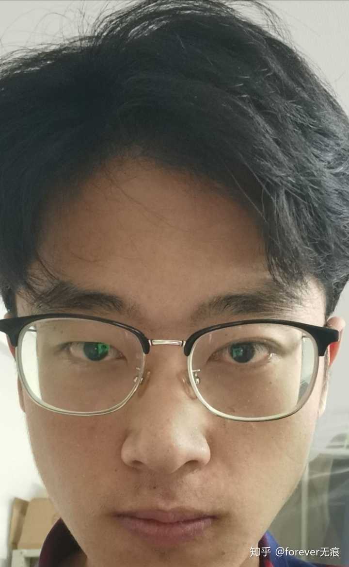 有没有人和我一样天生一个眼大一个眼小很明显大小眼