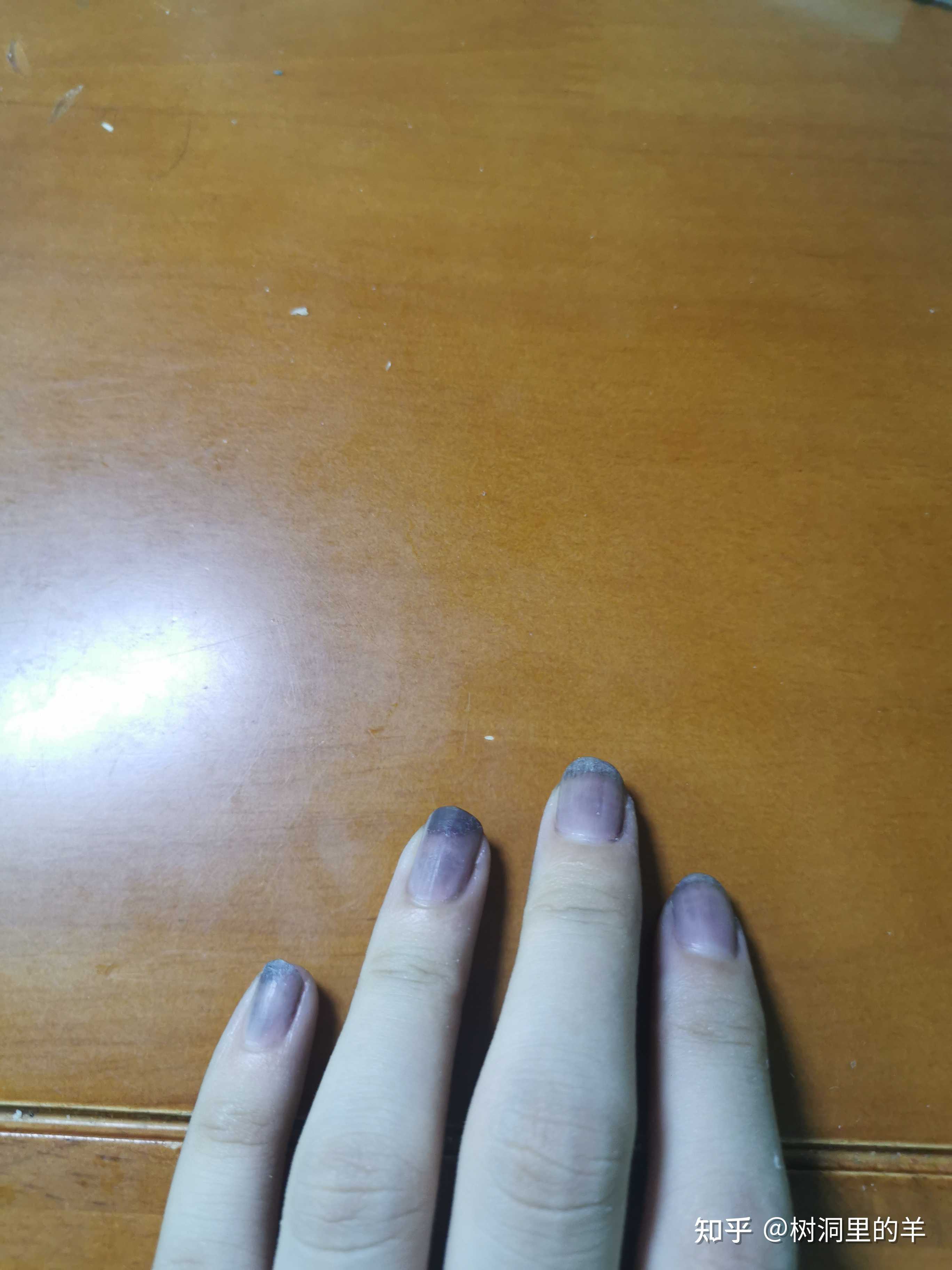 树洞里的羊 的想法 帮妈妈染头发,白得一套黑指甲(为啥不 知乎