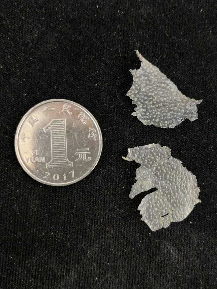 见过的最大头皮屑多大?