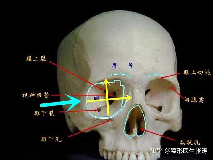 一般情况下,眼眶骨比较宽,比较高的人,眼睛会更大一些.