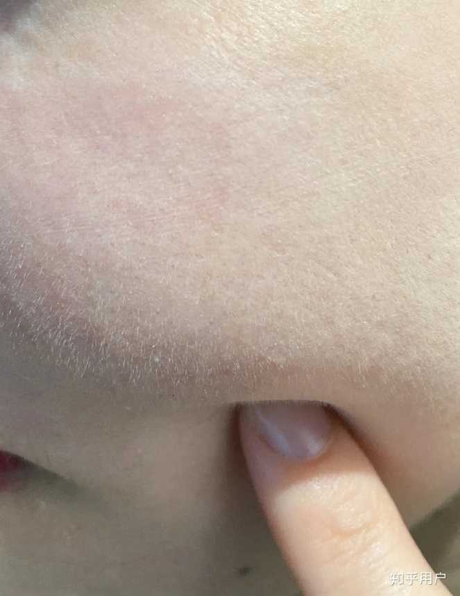 如何内养皮肤