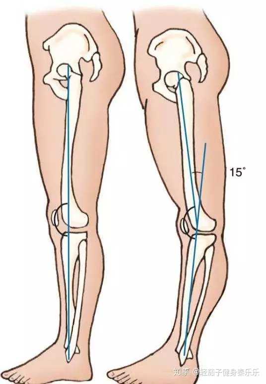 膝关节将从自然弯曲状态变为完全笔直,乃至于 整个膝盖窝向后凸的状态