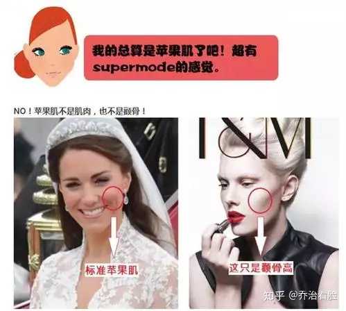 苹果肌由颧肌和颧脂肪垫组成,颧骨与上颌骨的饱满度与形状也对它的