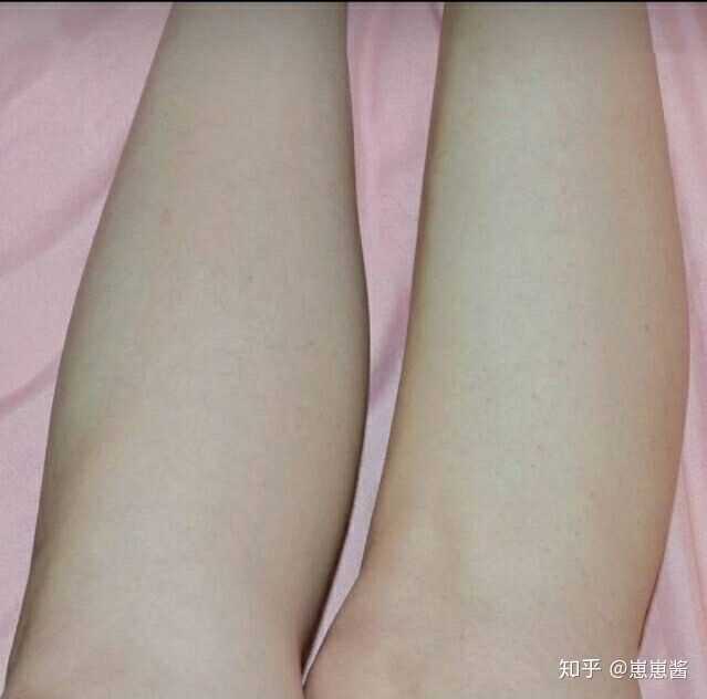 请问第一次腋下脱毛要怎么办?