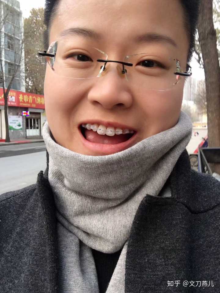 紧一遍牙套调整一下钢丝,几个月之后,下牙也戴了,这是在半年左右