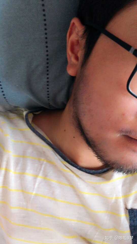 我这样算不算络腮胡有没有锦鲤让他不长出来我不敢刮胡子今年17比哪里有鱼苗办法图片