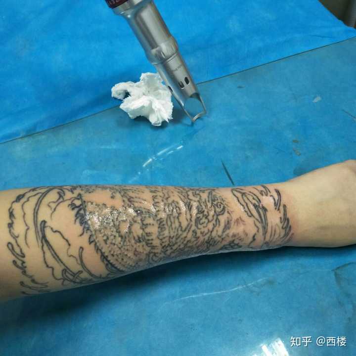 洗纹身是种什么样的体验?