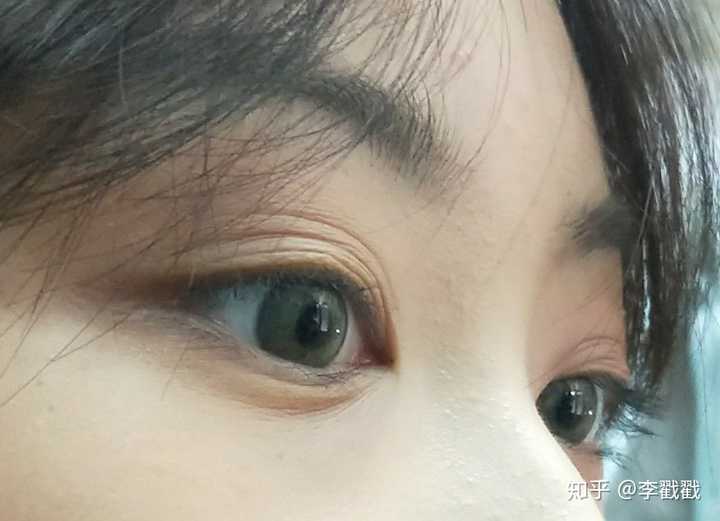 多眼皮是种什么体验?