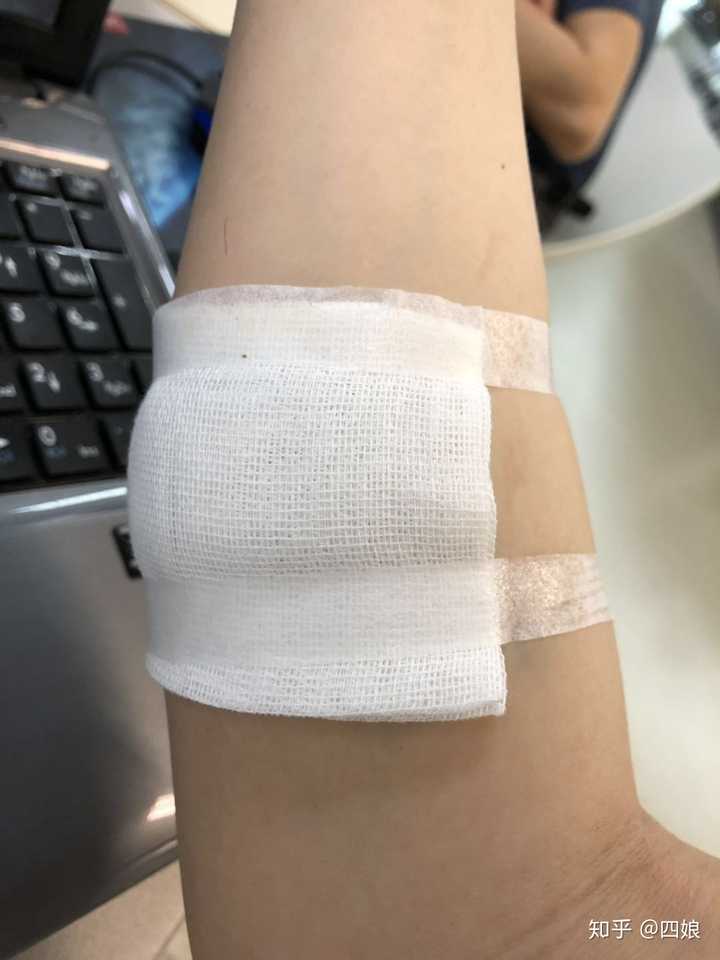 被开水烫伤怎么处理?