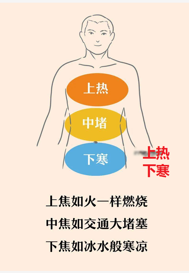 雷师兄健康 的想法: 腿脚凉,怕冷还爱上火?上热下寒办