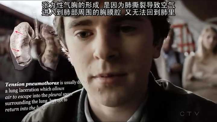 如何评价美剧《良医》第一季与第二季(the good doctor)?