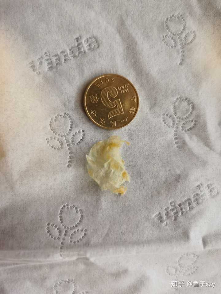 耳屎最大能有多大?