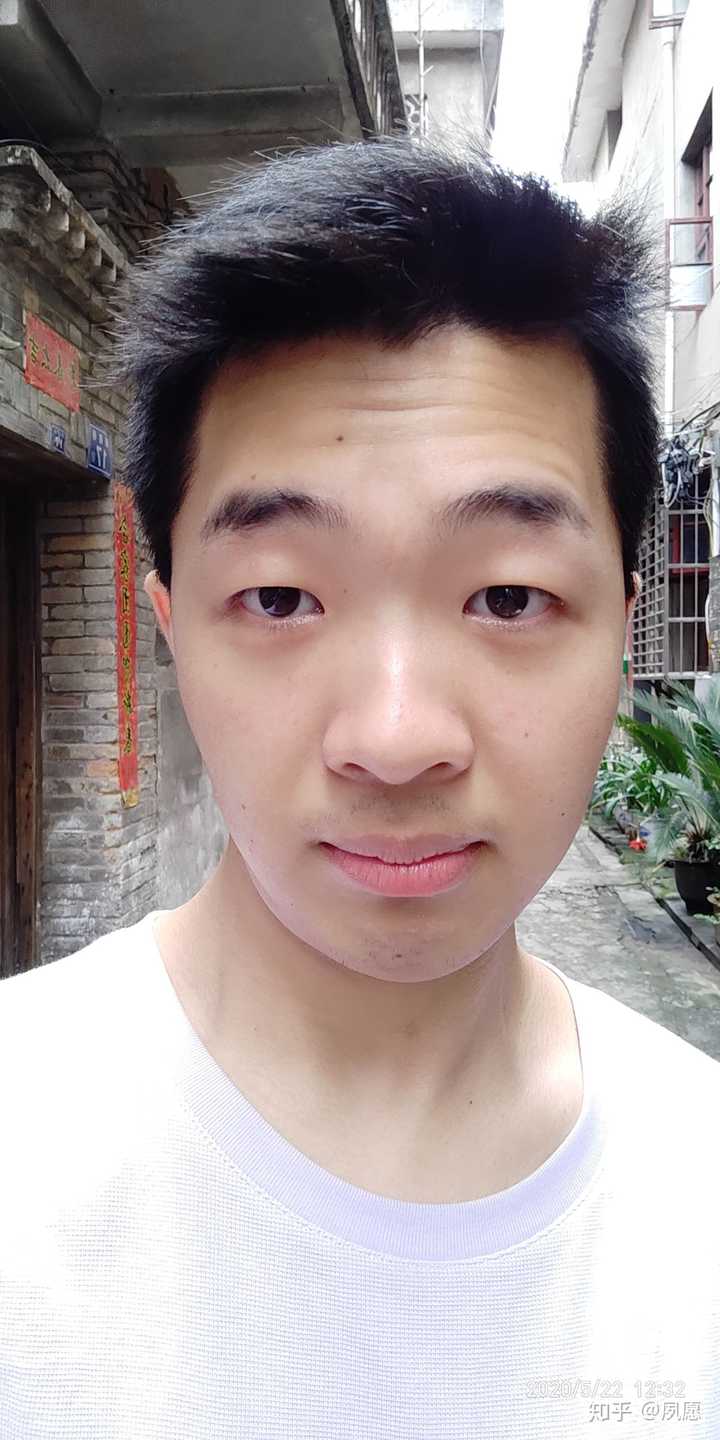 我这大小脸还有救吗.特别自卑不敢拍照,已上图?