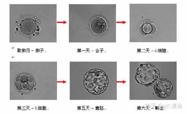 只有发育到囊胚期后才迁移到子宫腔内着床,理论上,移植囊胚更符合自然