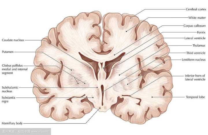 大脑冠状切面标本(可观察到左右对称的侧脑室和位于下方的第三