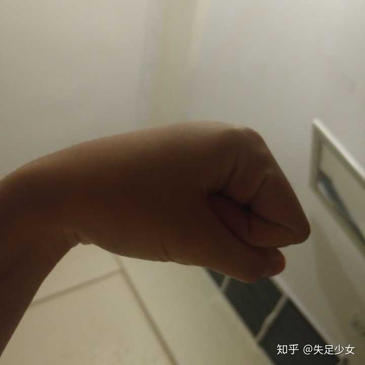 被蚂蚁咬了,伤口周围有硬物感,中间还有个小泡,今天是