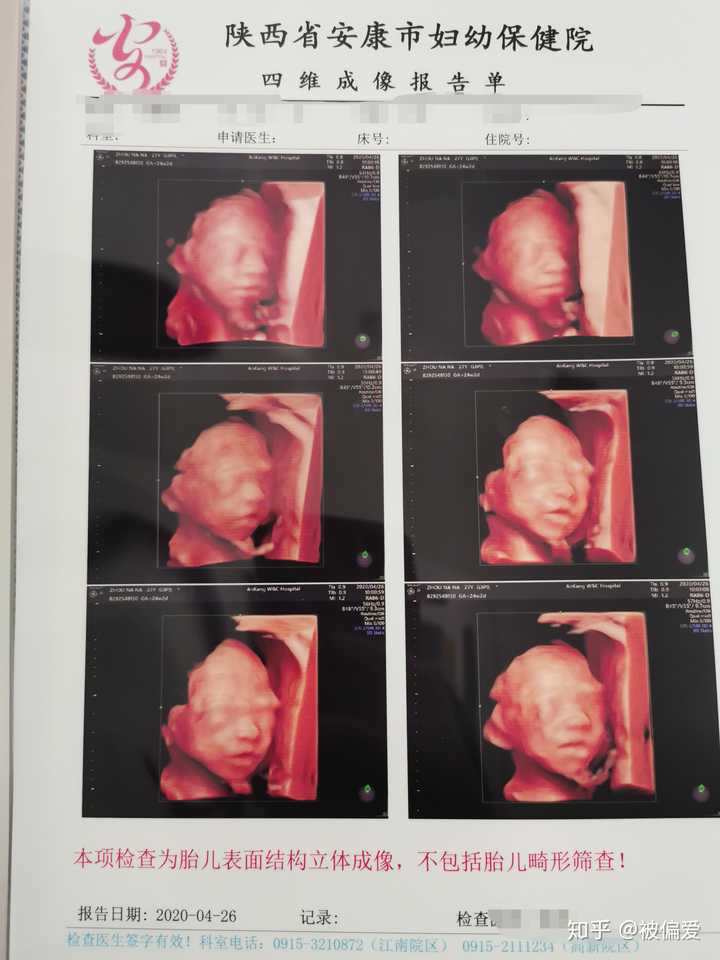 你第一次看到宝宝的四维彩超照片,是什么感觉?