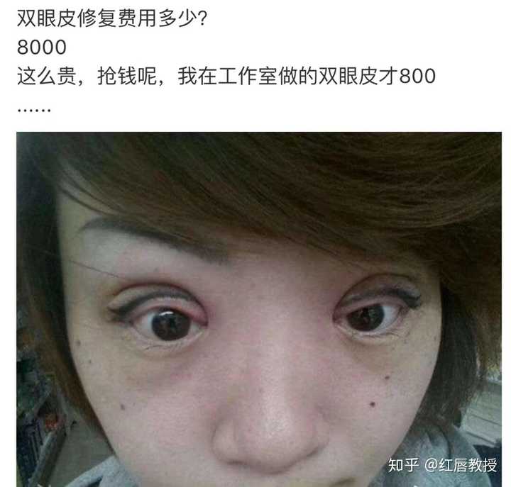 割双眼皮有什么危险吗?