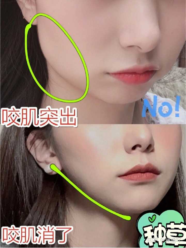 咬肌大会有对象吗?