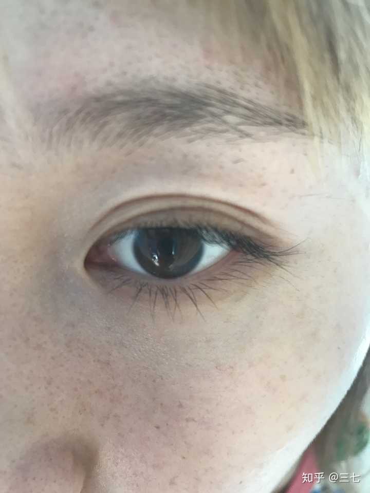 这是没割之前的三眼皮